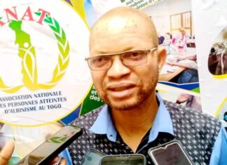 Togo: l’ANAT consolide ses actions en faveur des personnes atteintes d’albinisme au Togo